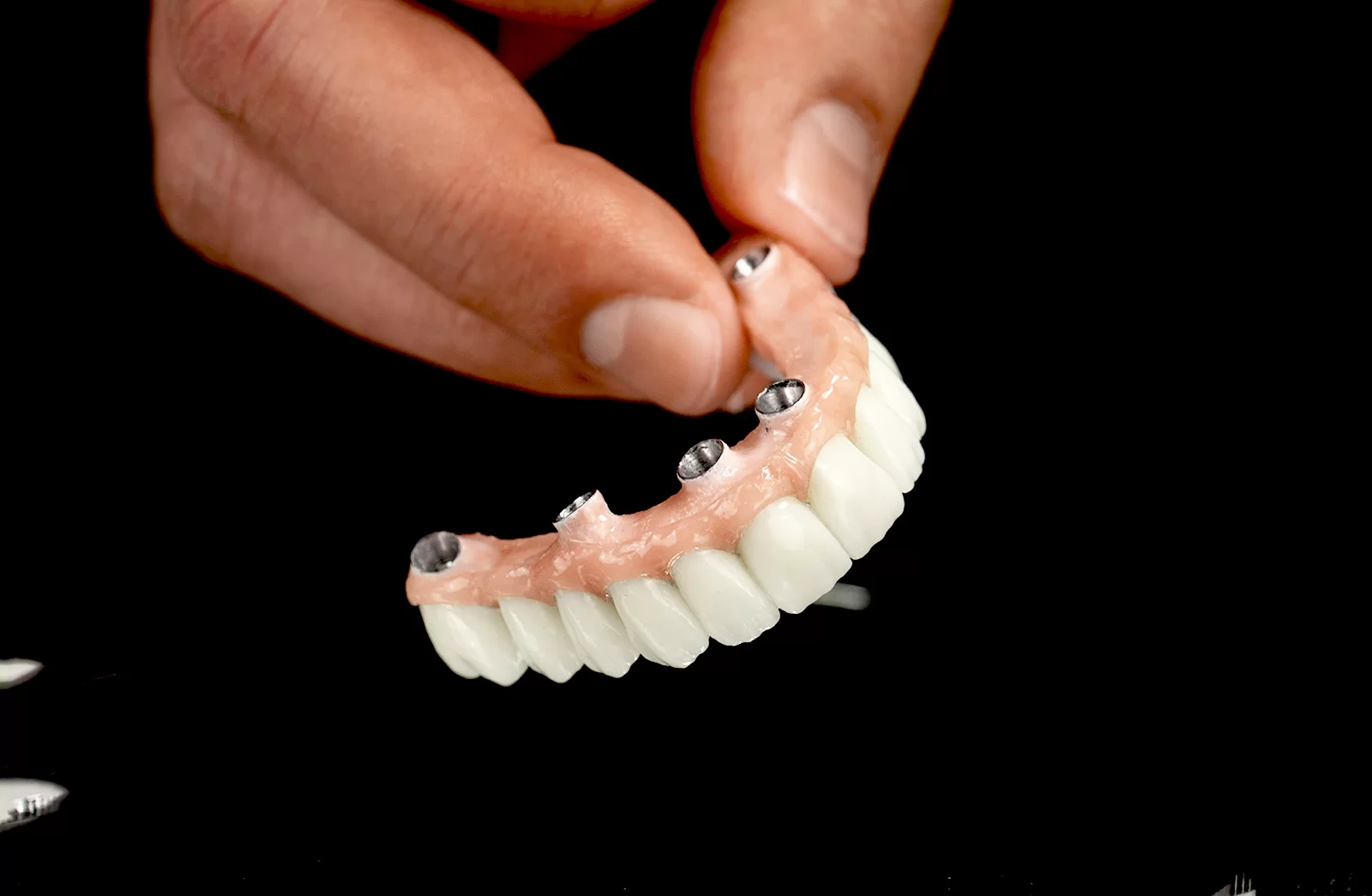 Restoration of the edentulous jaw with implants